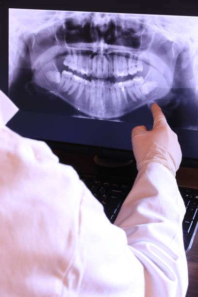 Best Emergency Dental Extractions in River Road, NC