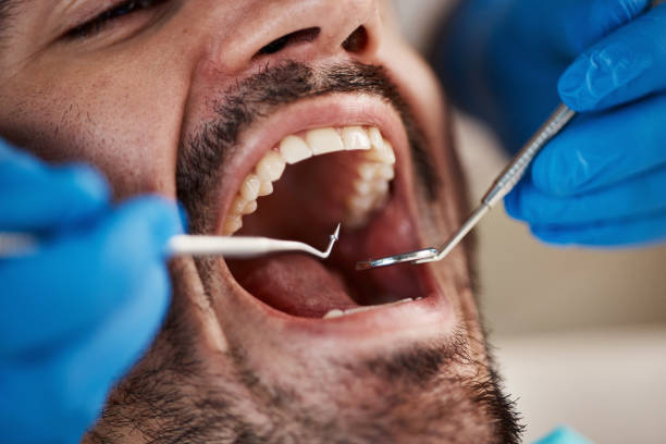 Best Emergency Dental Extractions in River Road, NC